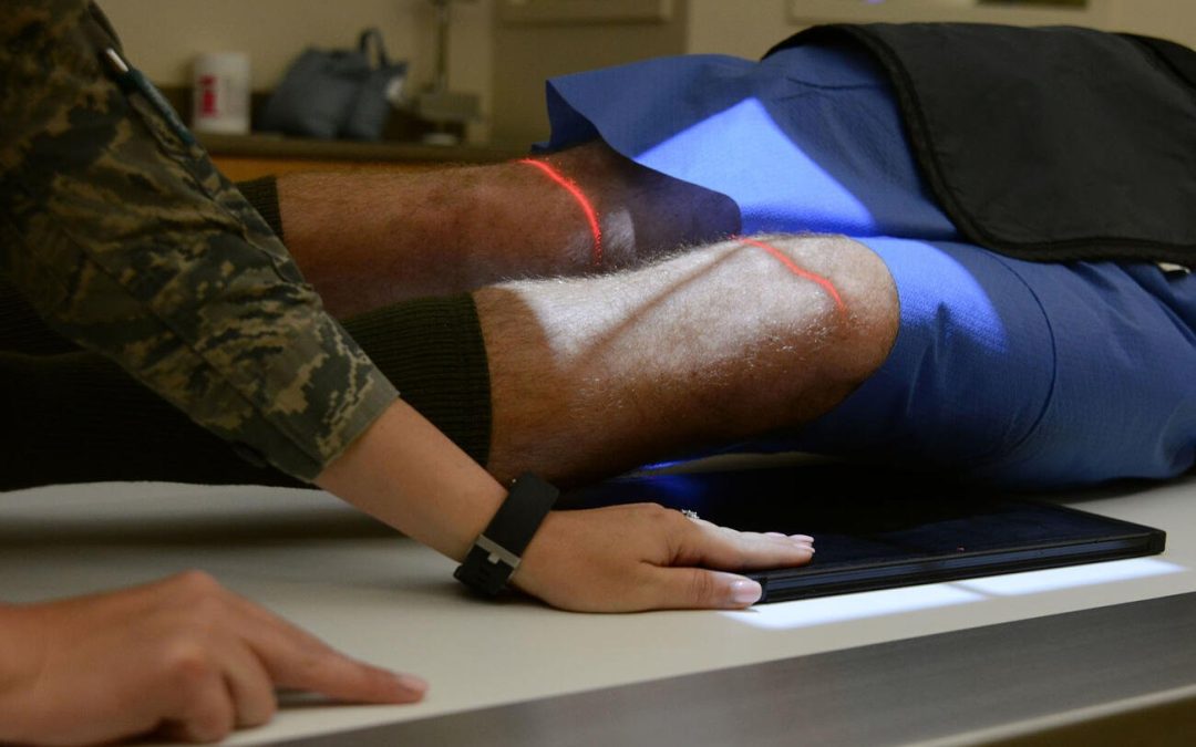 Familiar Nutrient May Help Regrow Soldiers’ Muscles After Wartime Blast Injuries